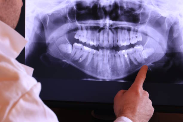 Best Emergency Tooth Extraction in Greenville, NC