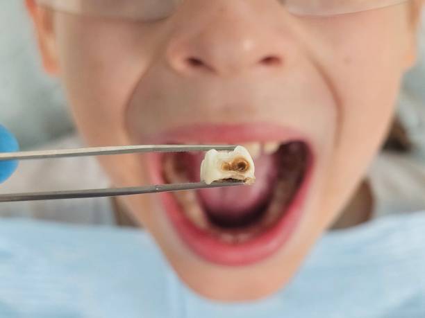 Best Emergency Denture Repair in Greenville, NC