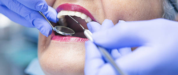 Best Emergency Tooth Extraction in Greenville, NC